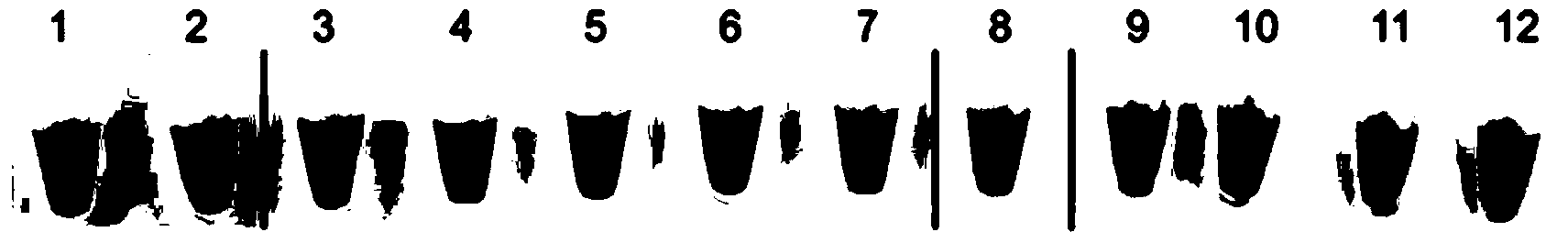 Primer combination for detecting Phialophora gregata by loop-mediated isotherm amplification technique and application thereof