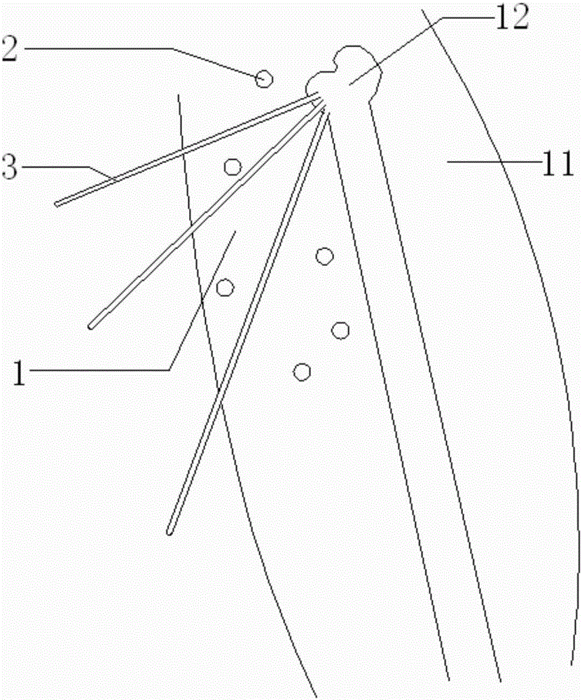 Percutaneous navigation guide board combined with body position fixation device and preparation method thereof