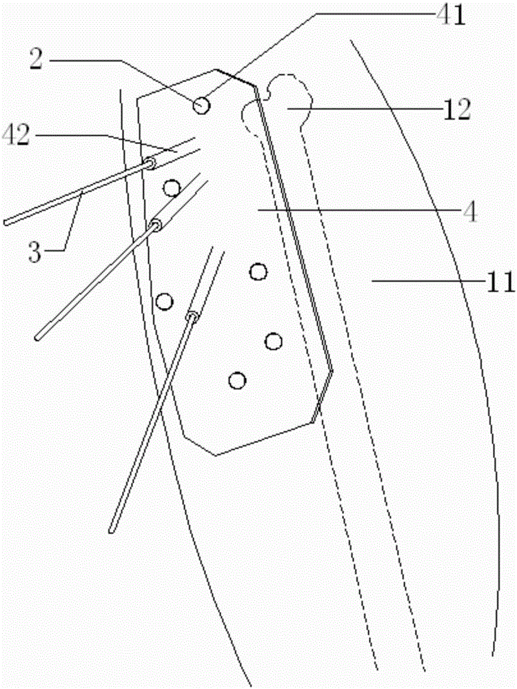 Percutaneous navigation guide board combined with body position fixation device and preparation method thereof