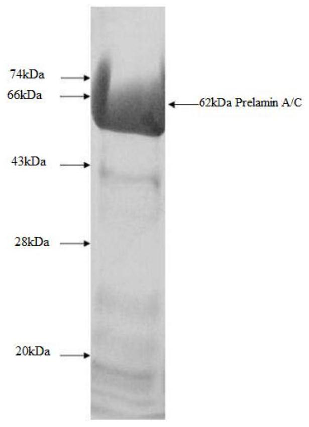 A test kit for detecting anti-prelamin A/C-IgG antibody