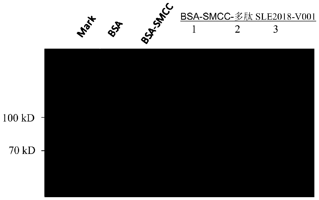 Application of peptide SLE2018-V001 in the diagnosis of systemic lupus erythematosus kit