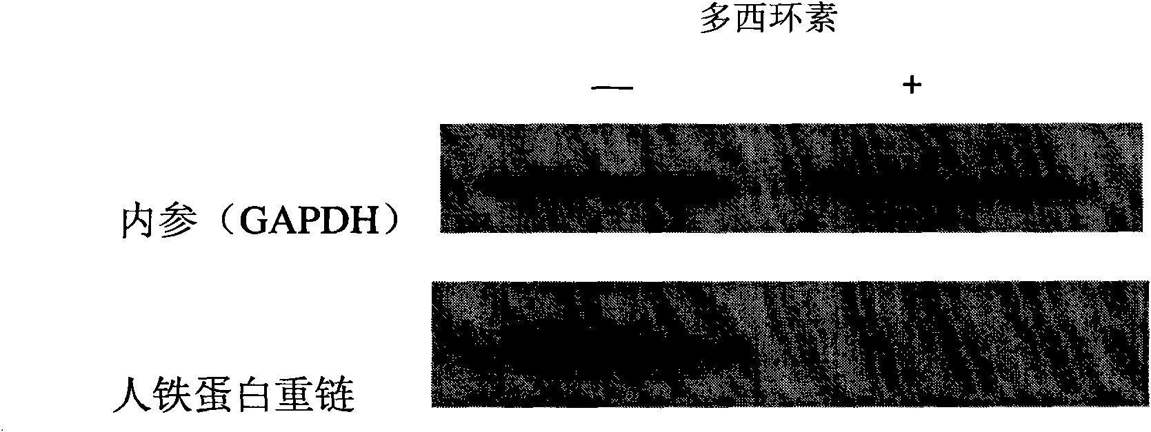 Tet-Off Advanced human stably expressing high-transition nasopharyngeal carcinoma cell line S18, construction method thereof and application thereof