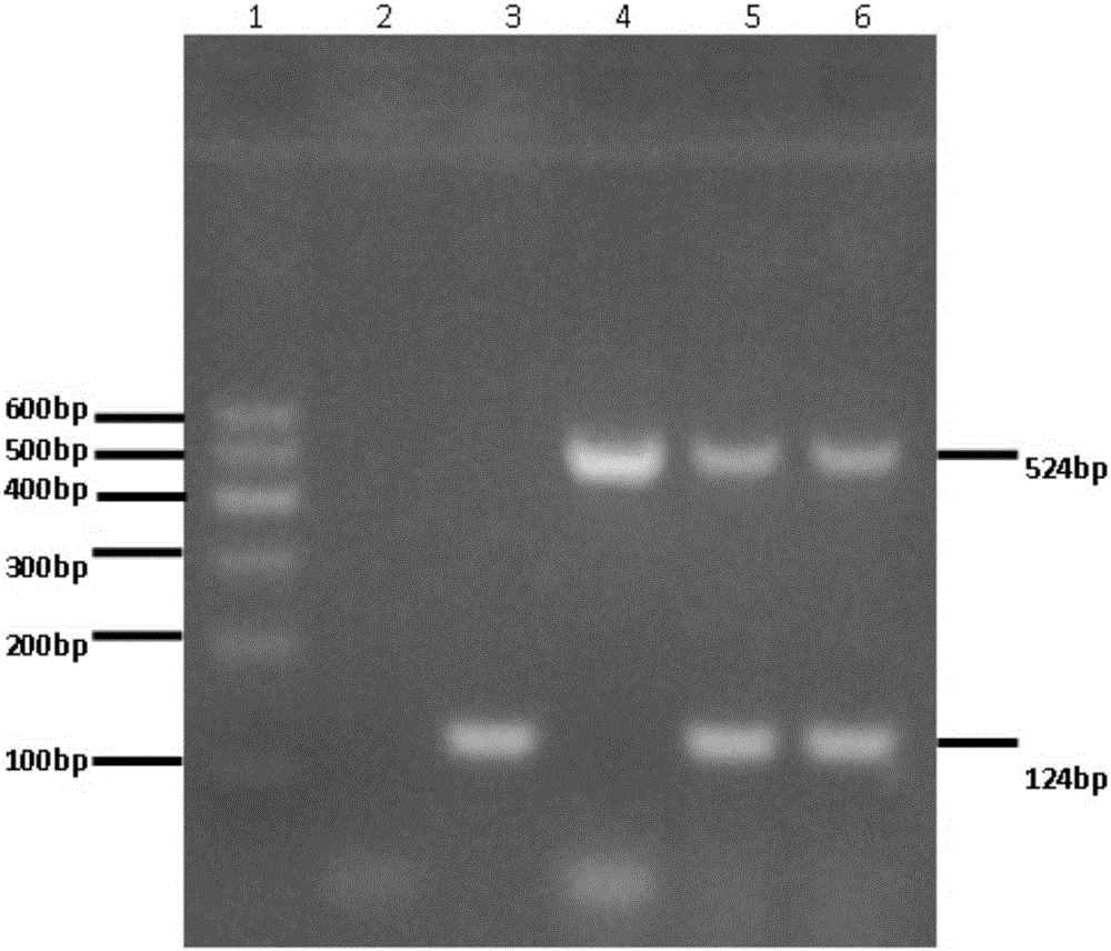 Kit and detection method for simultaneously detecting vibrio bacteria and edwardsiella ictaluri