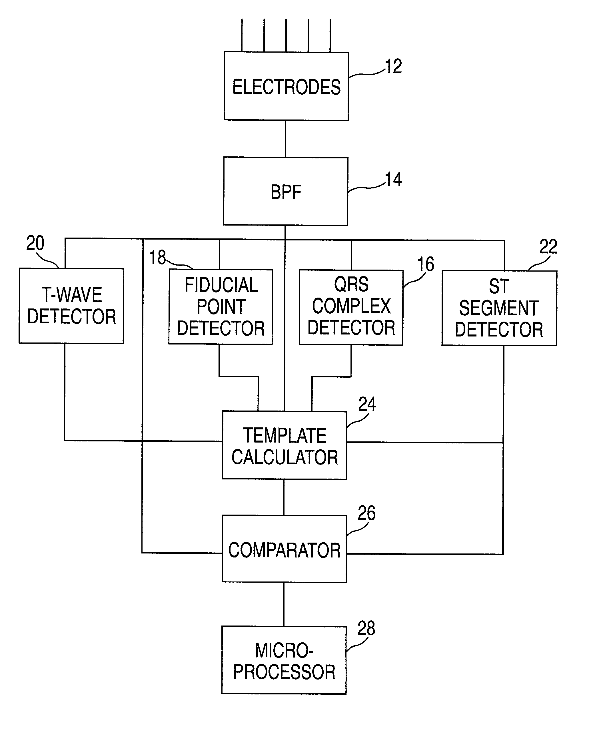 Method and apparatus for monitoring cardiac patients for T-wave alternans