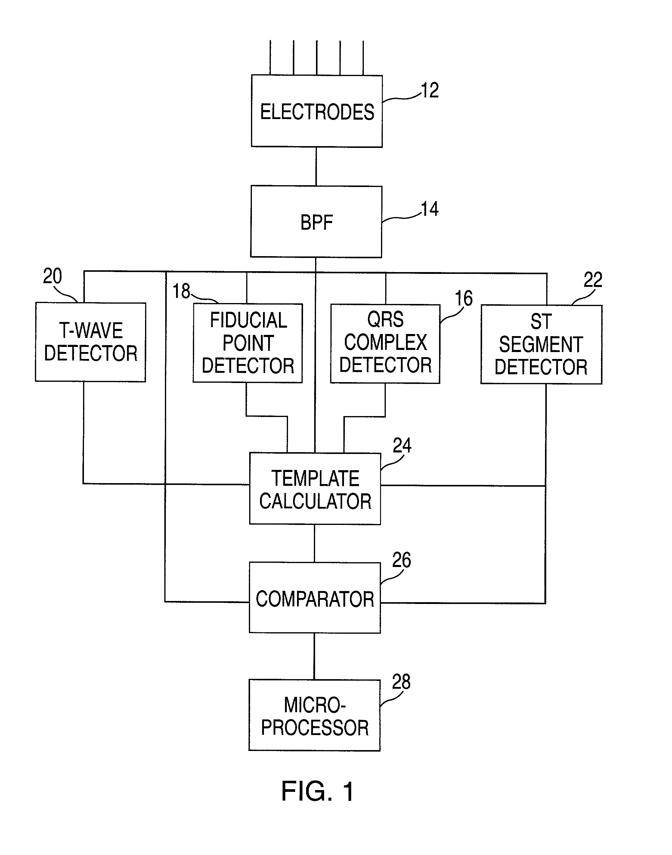 Method and apparatus for monitoring cardiac patients for T-wave alternans
