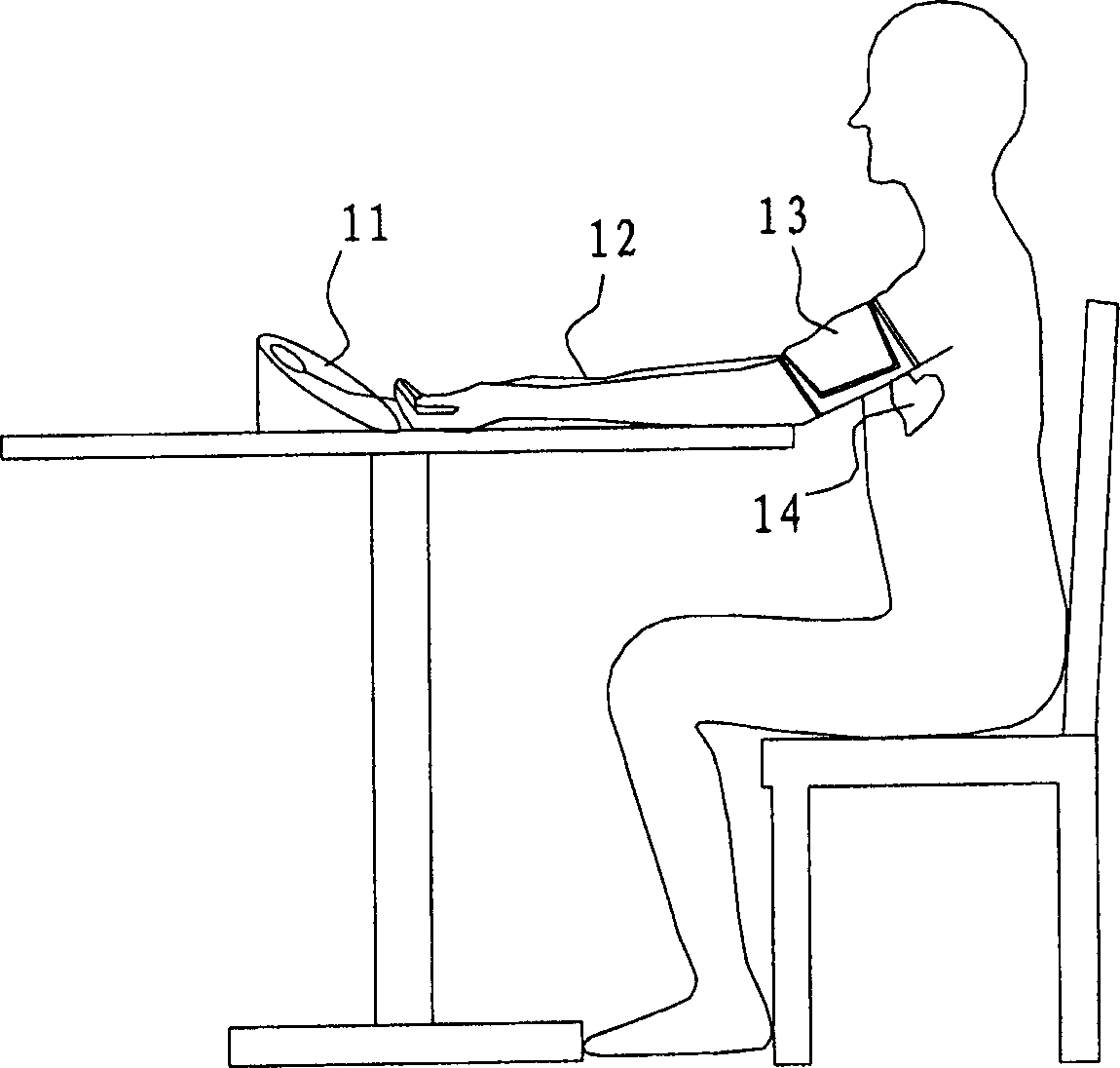 blood-pressure-device-with-pressure-signal-wireless-transmission