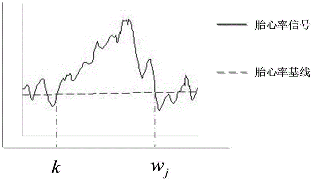 Extraction method for cardiotocography acceleration characteristic parameters