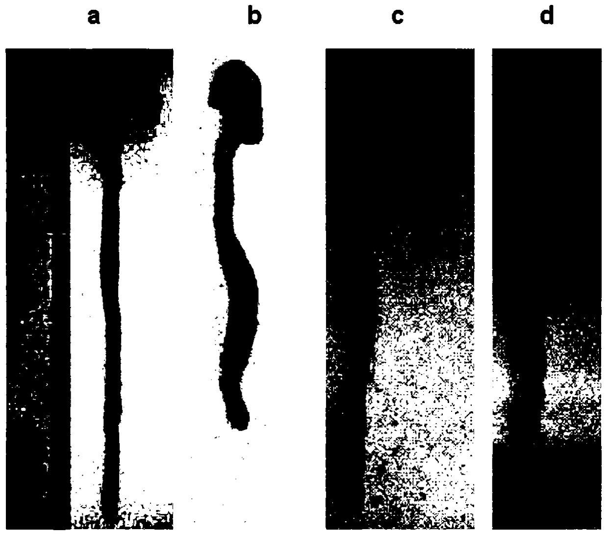 The use of notoginseng saponin ft1