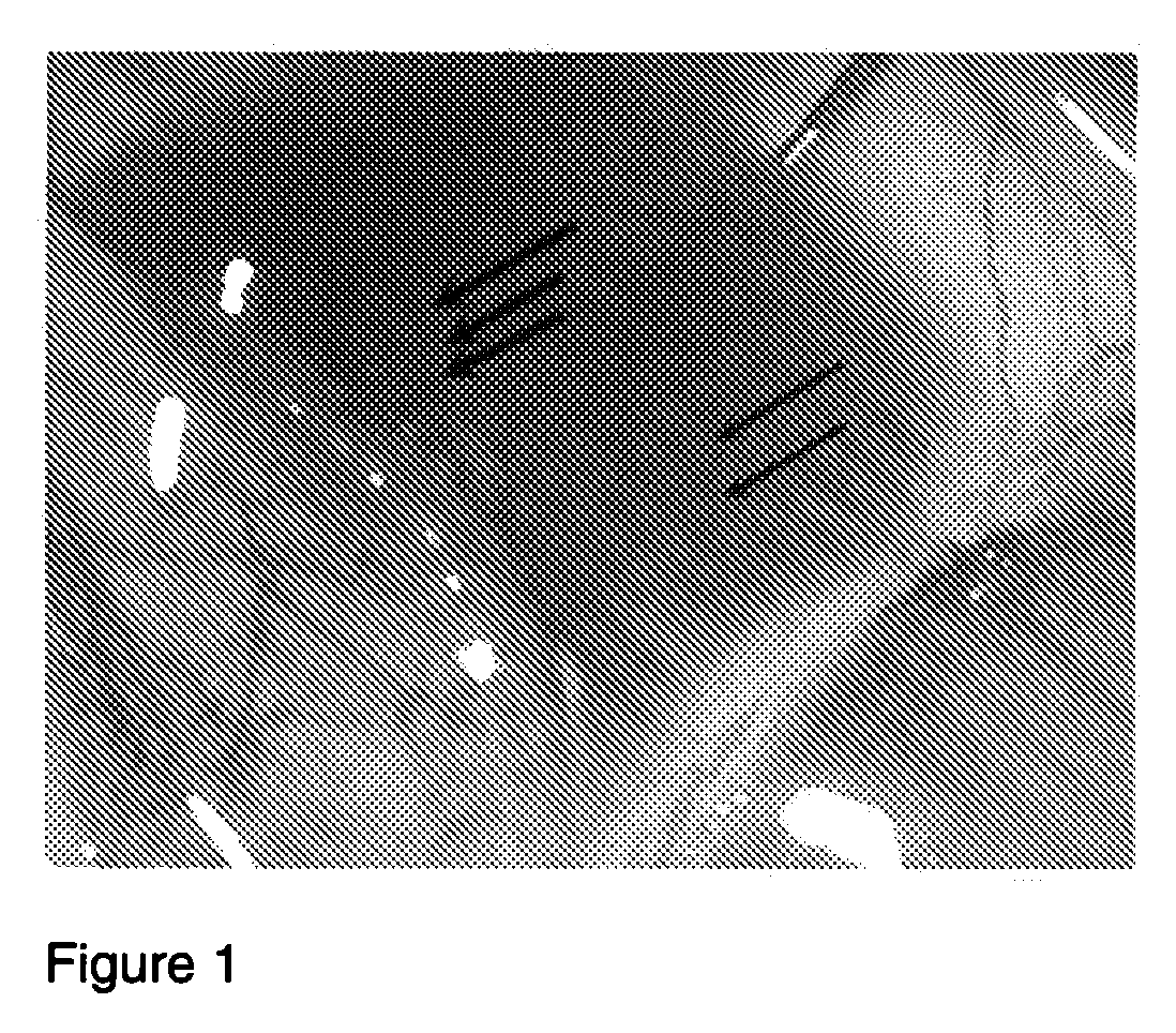 Drug delivery systems and methods for treating neovascularization