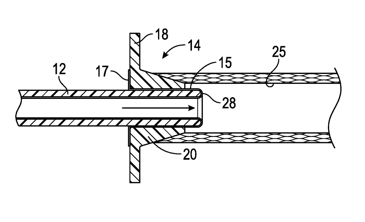 Urinary catheter assembly and method