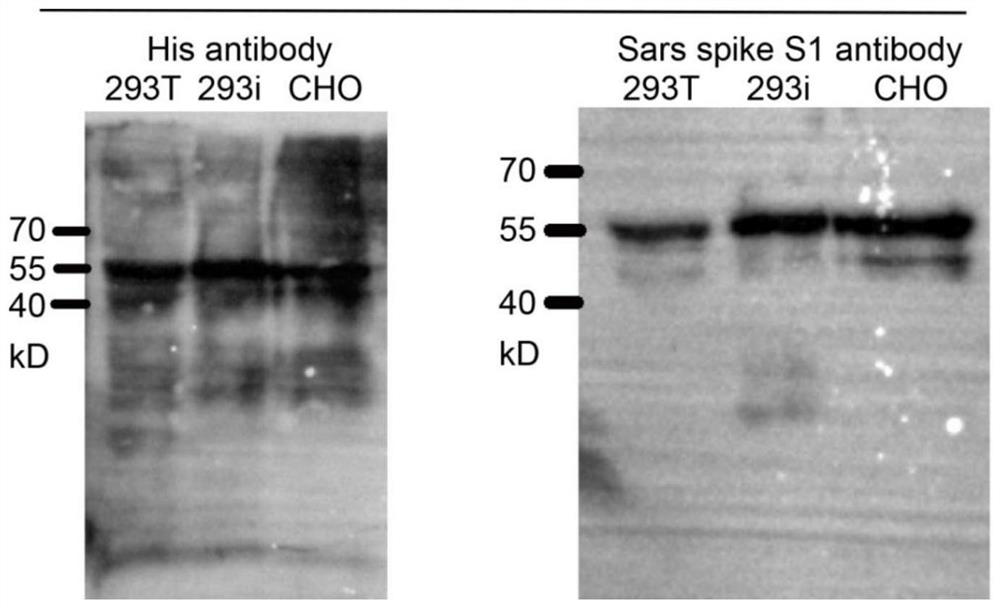 Nano vaccine taking SARS-CoV-2 virus S protein RBD region as antigen and preparation method of nano vaccine