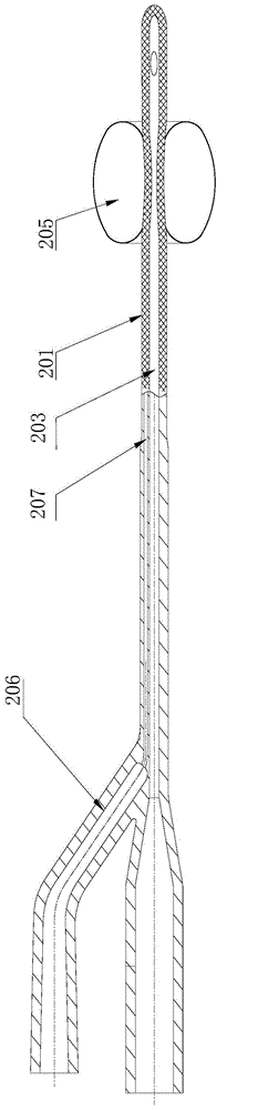 Sacculus catheter and preparing methods thereof