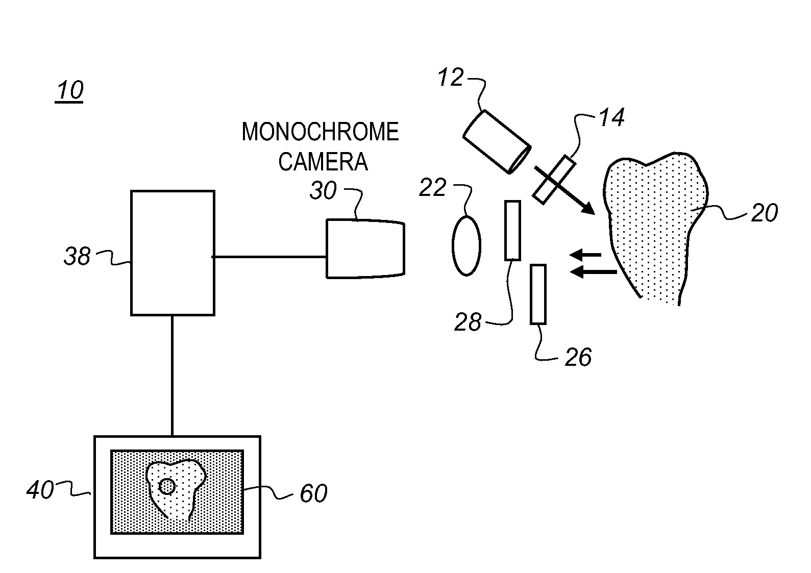 Method and apparatus for detection of caries