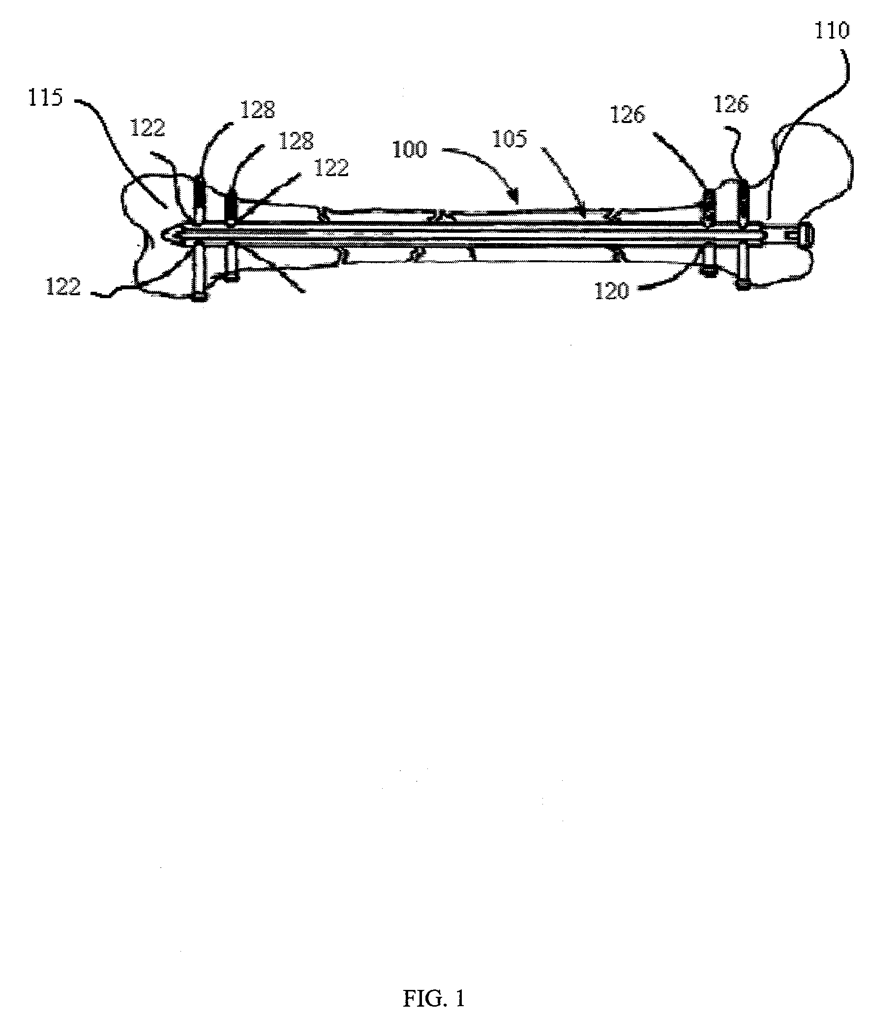 System and method for securing surgical implant
