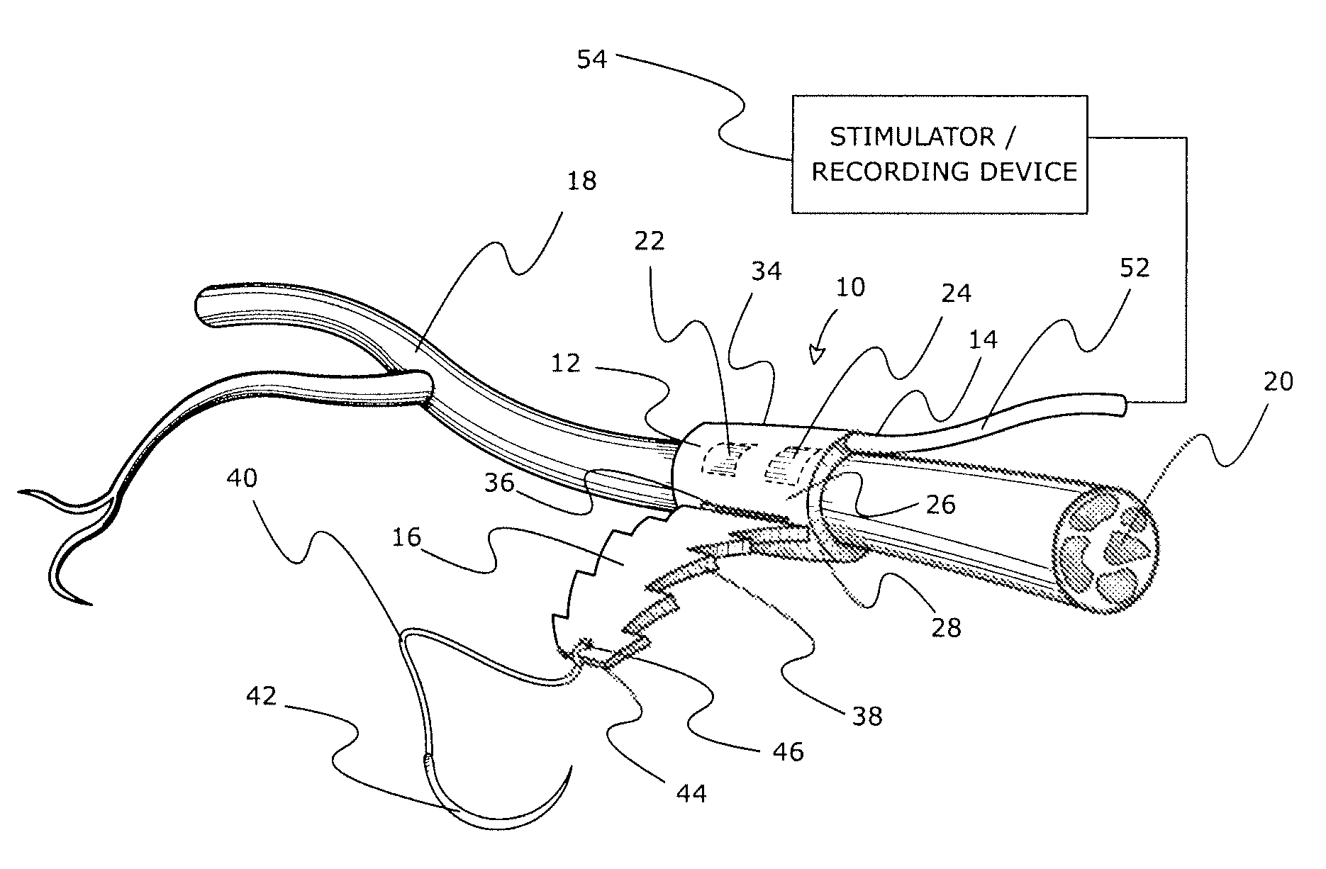 Adjustable tissue or nerve cuff and method of use