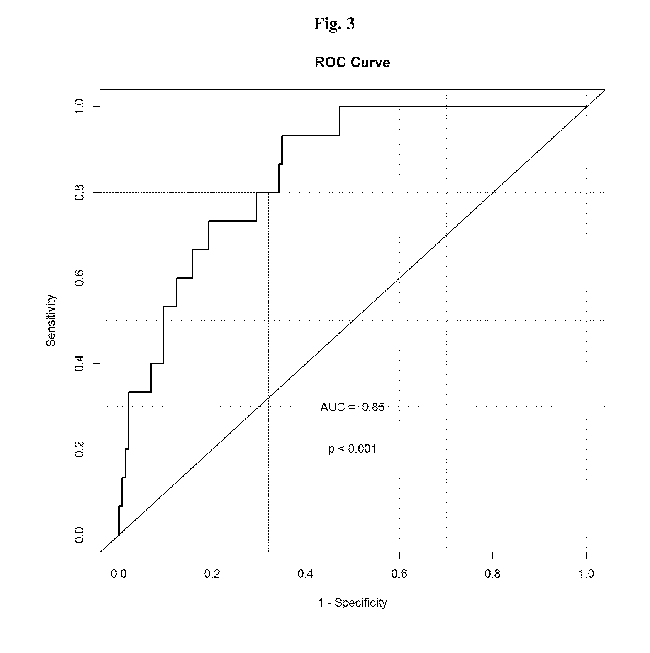 LKB1 Levels and Brain Metastasis from Non-Small-Cell Lung Cancer (NSCLC)