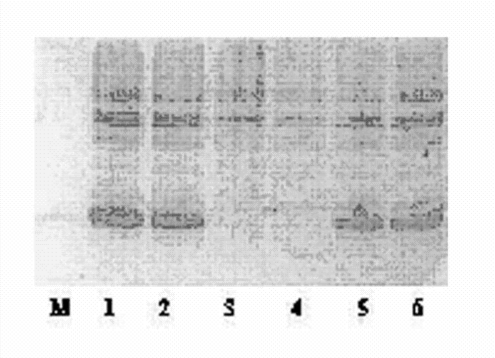 Kringle 5 mutant protein, and preparation method and application thereof