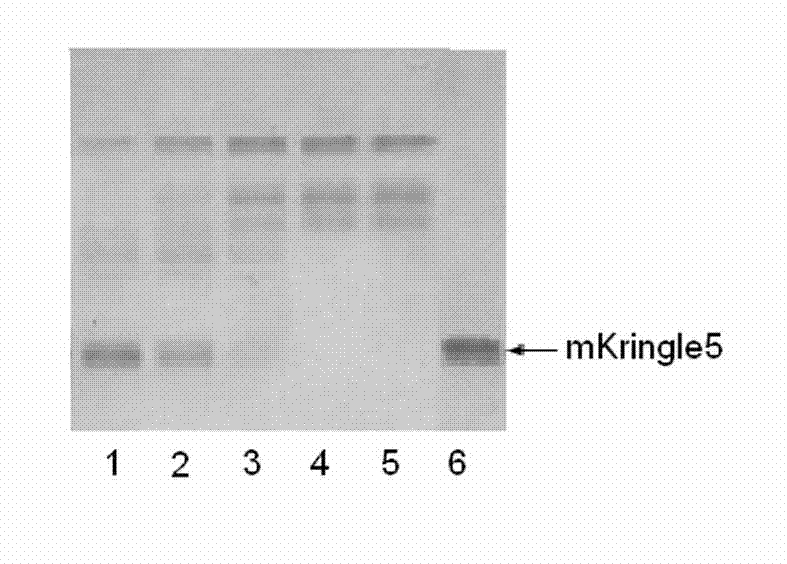 Kringle 5 mutant protein, and preparation method and application thereof