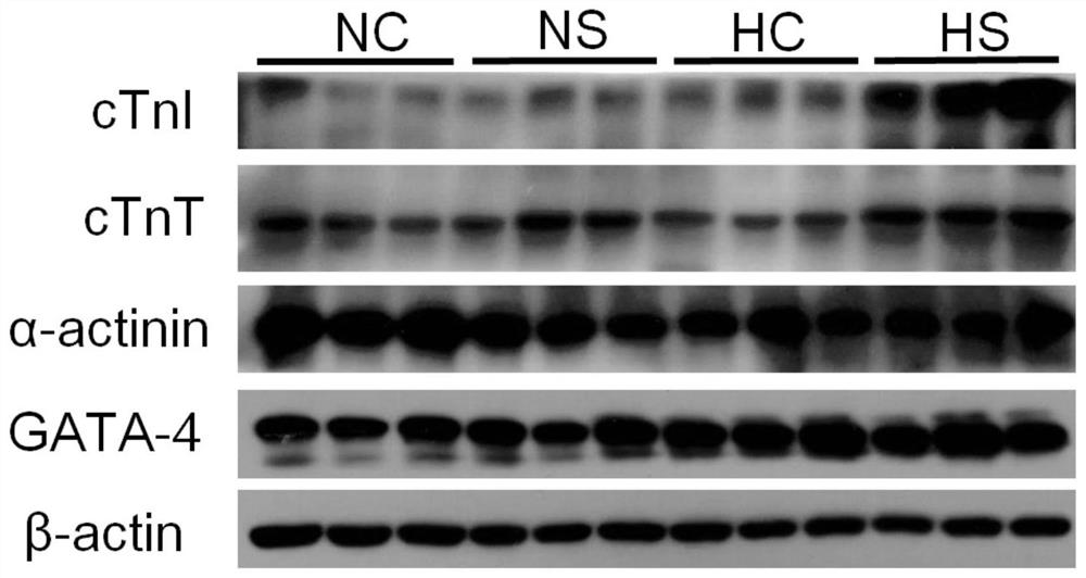 Application of rhodiola rosea and salidroside in the directed differentiation of stem cells into cardiomyocyte-like cells