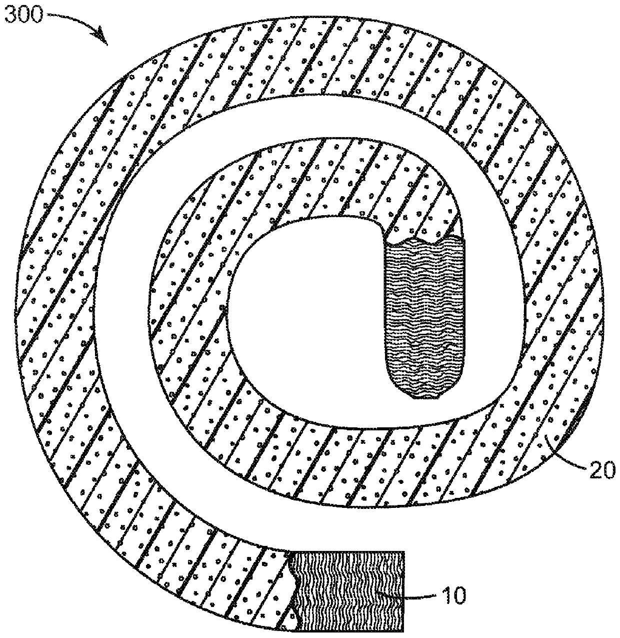 Articles and methods for negative pressure wound therapy