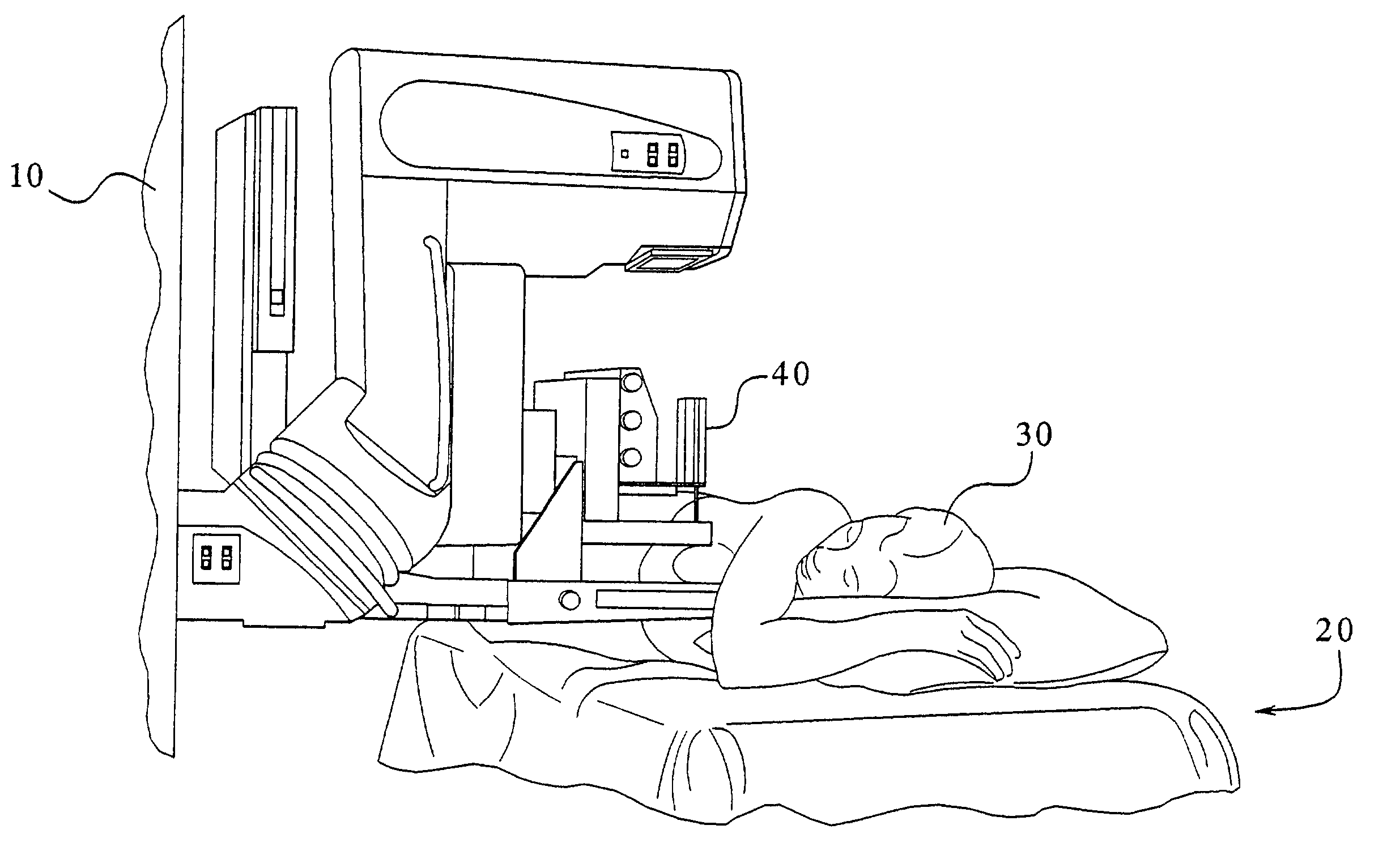Apparatus and method for interstitial laser therapy of small breast cancers and adjunctive therapy