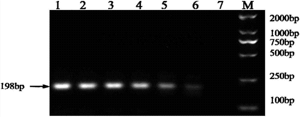 Double fluorescent quantitative RT-PCR (reverse transcription-polymerase chain reaction) kit for detecting dengue virus and zika virus