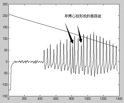 Double-air-bag oscillatory wave signal detecting method