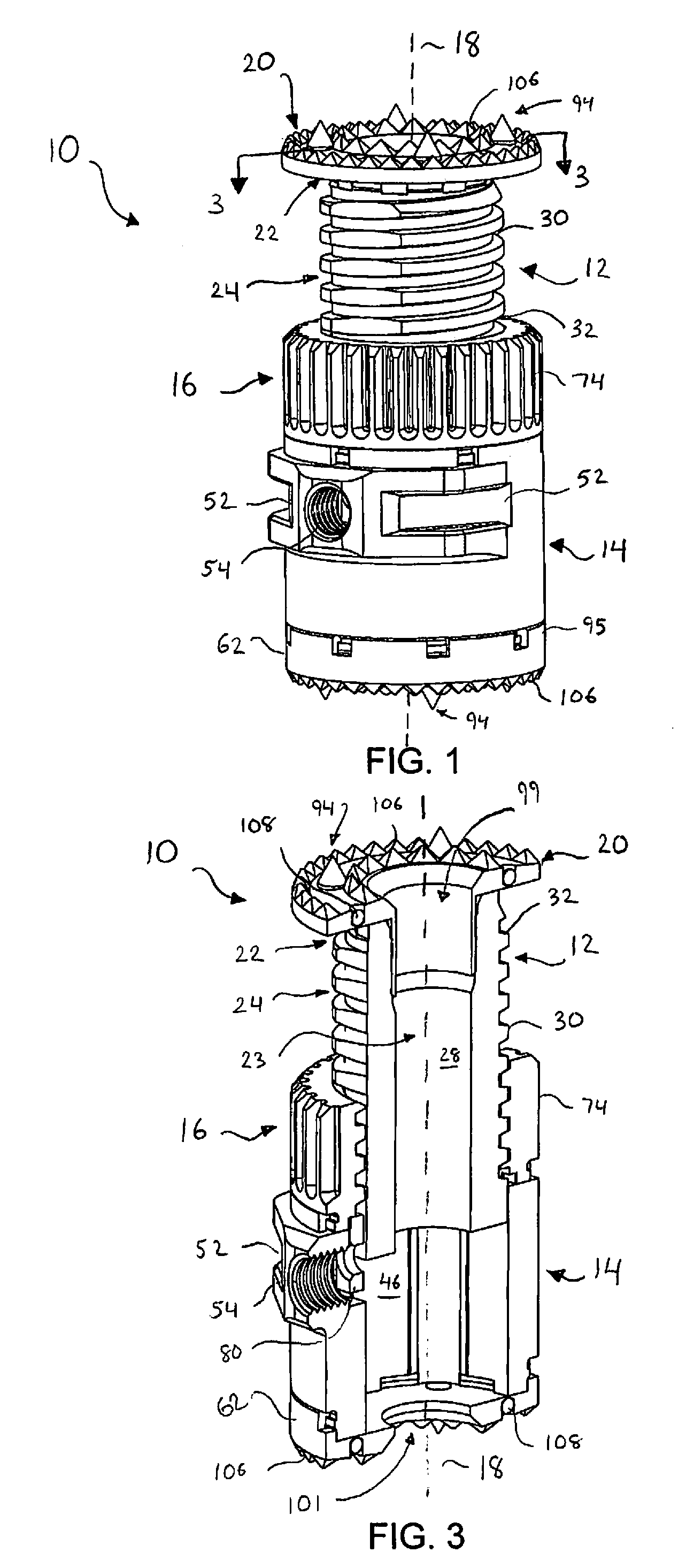 Expandable Vertebral Implant