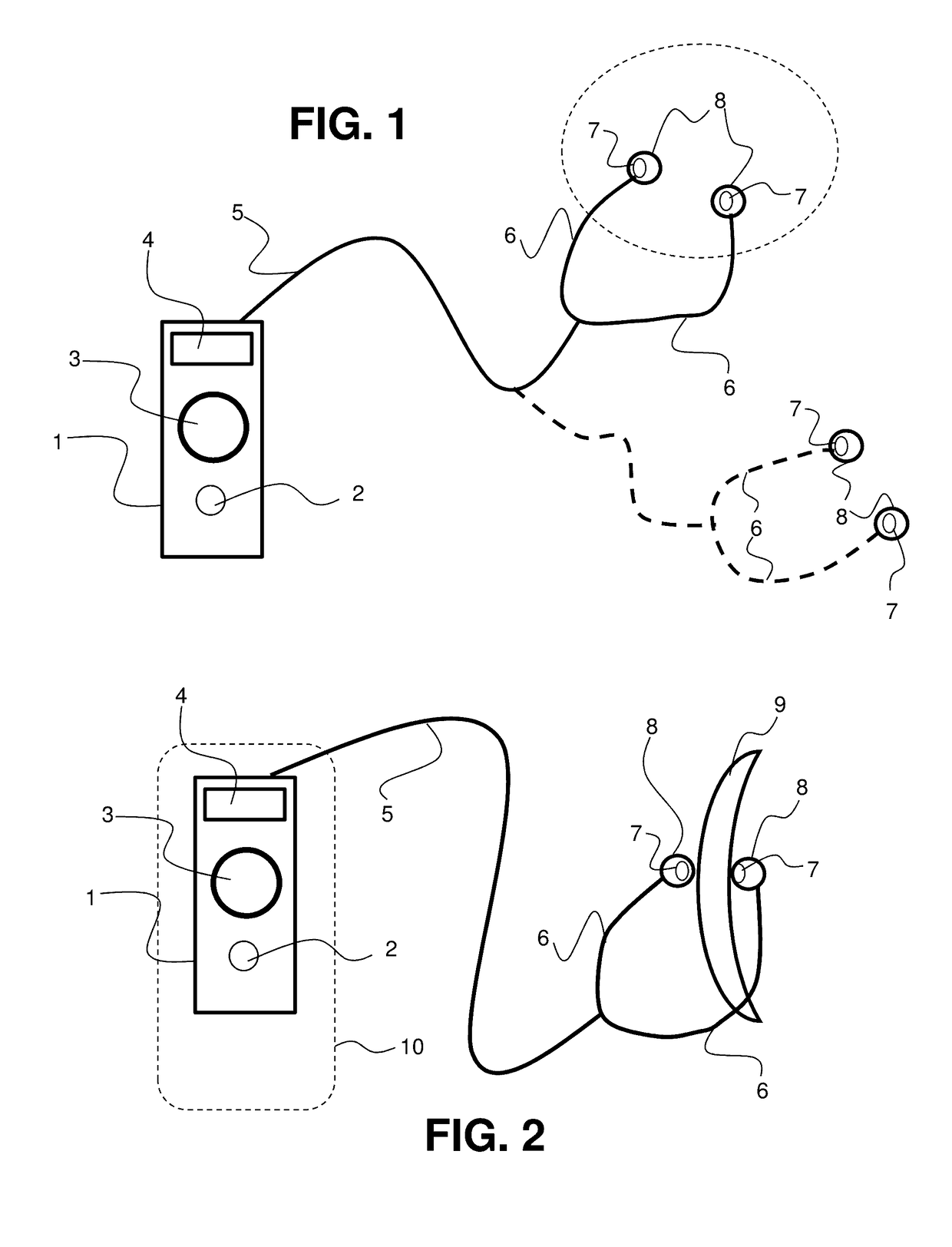 Transcutaneous electrostimulator and methods for electric stimulation