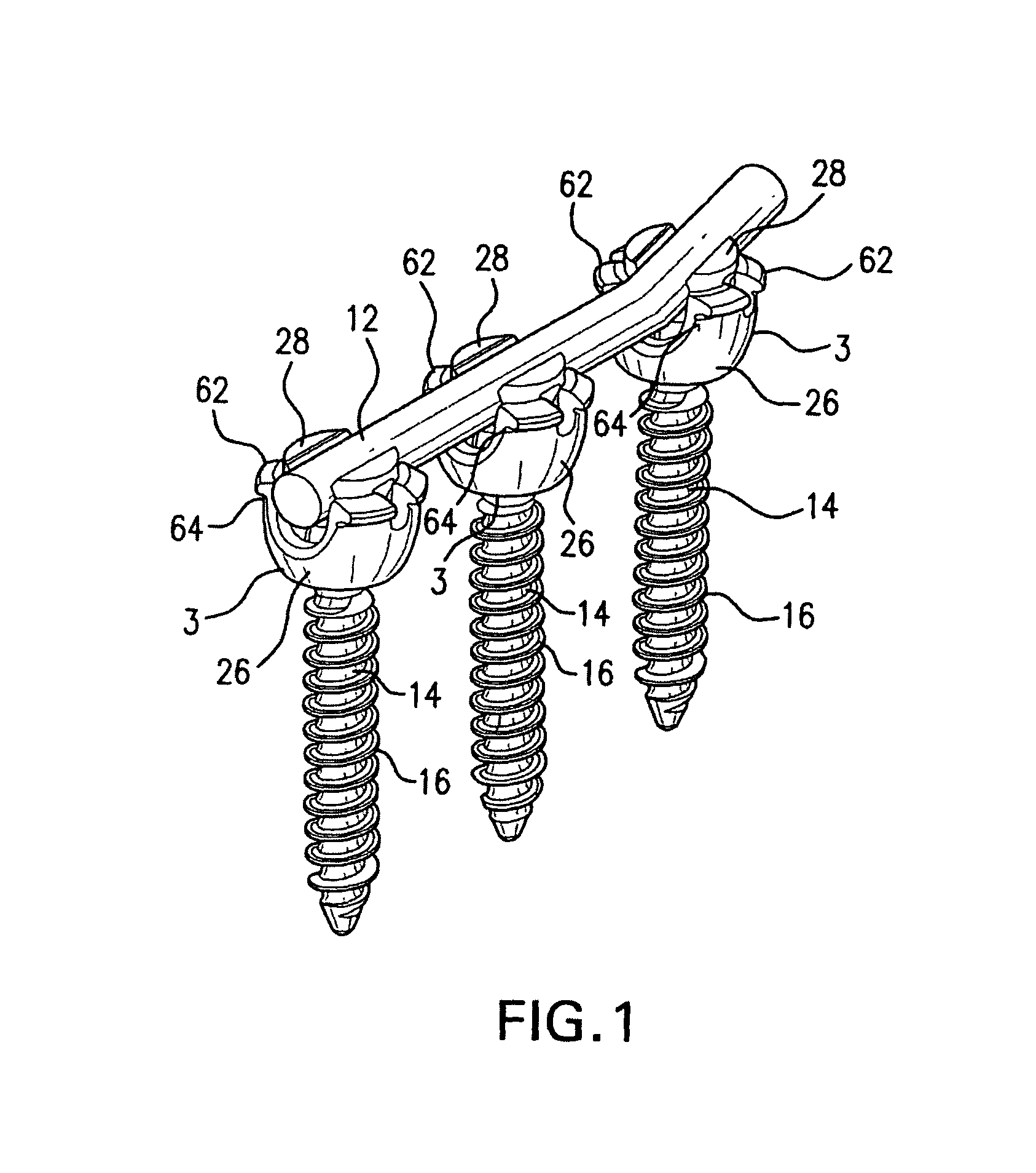 Spinal fixation system having locking and unlocking devices for use with a multi-planar, taper lock screw
