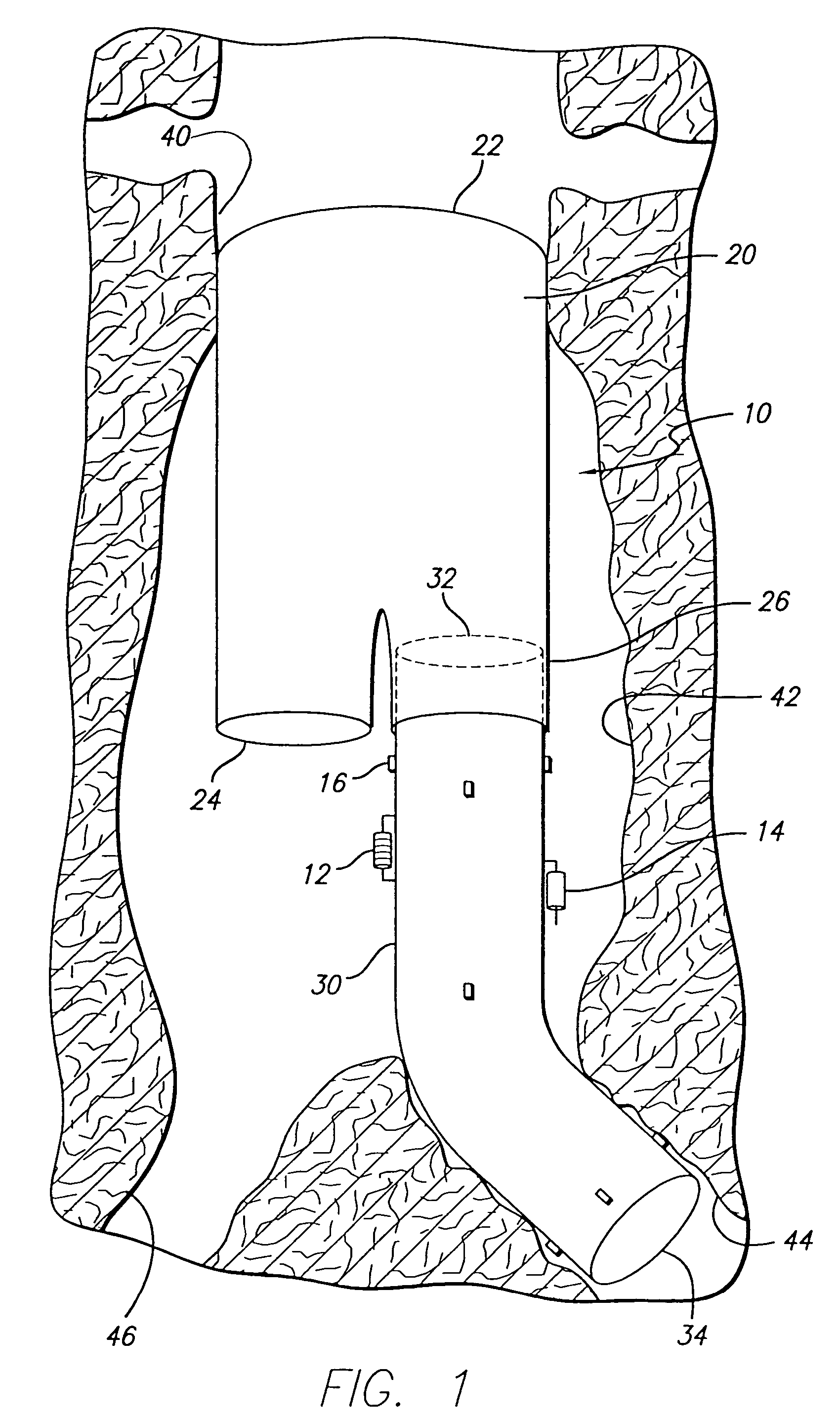 Endovascular graft with pressor and attachment methods