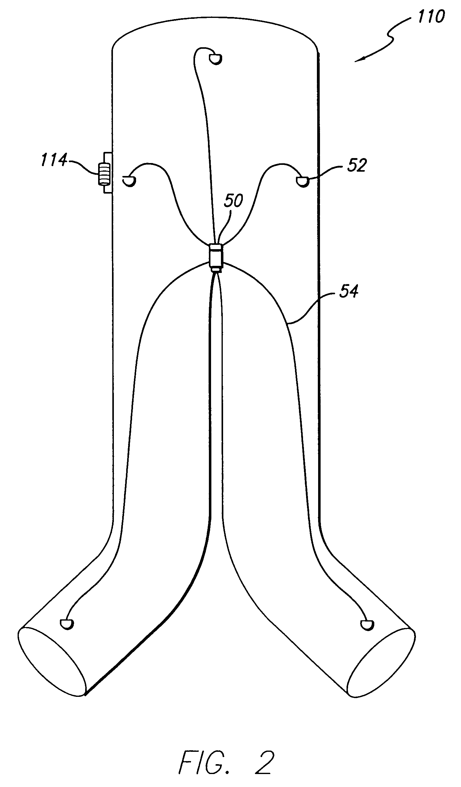 Endovascular graft with pressor and attachment methods