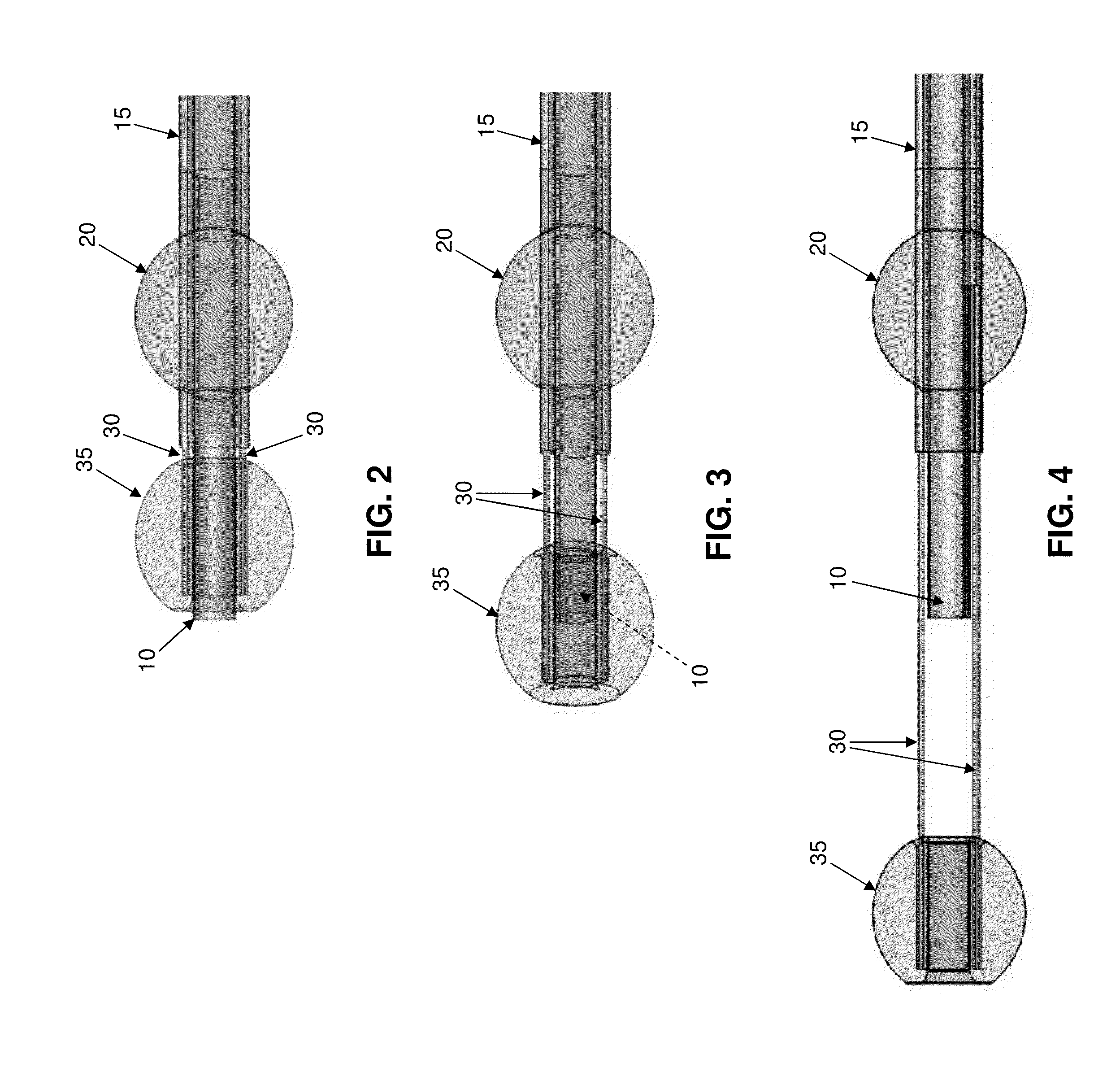 Method and apparatus for manipulating the side wall of a body lumen or body cavity so as to provide increased visualization of the same and/or increased access to the same, and/or for stabilizing instruments relative to the same