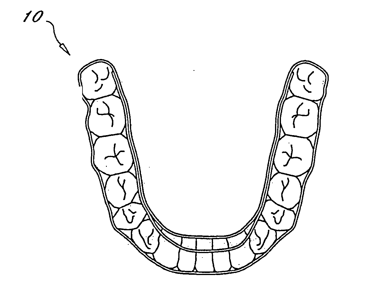 Orthodontic appliance with embedded wire for moving teeth