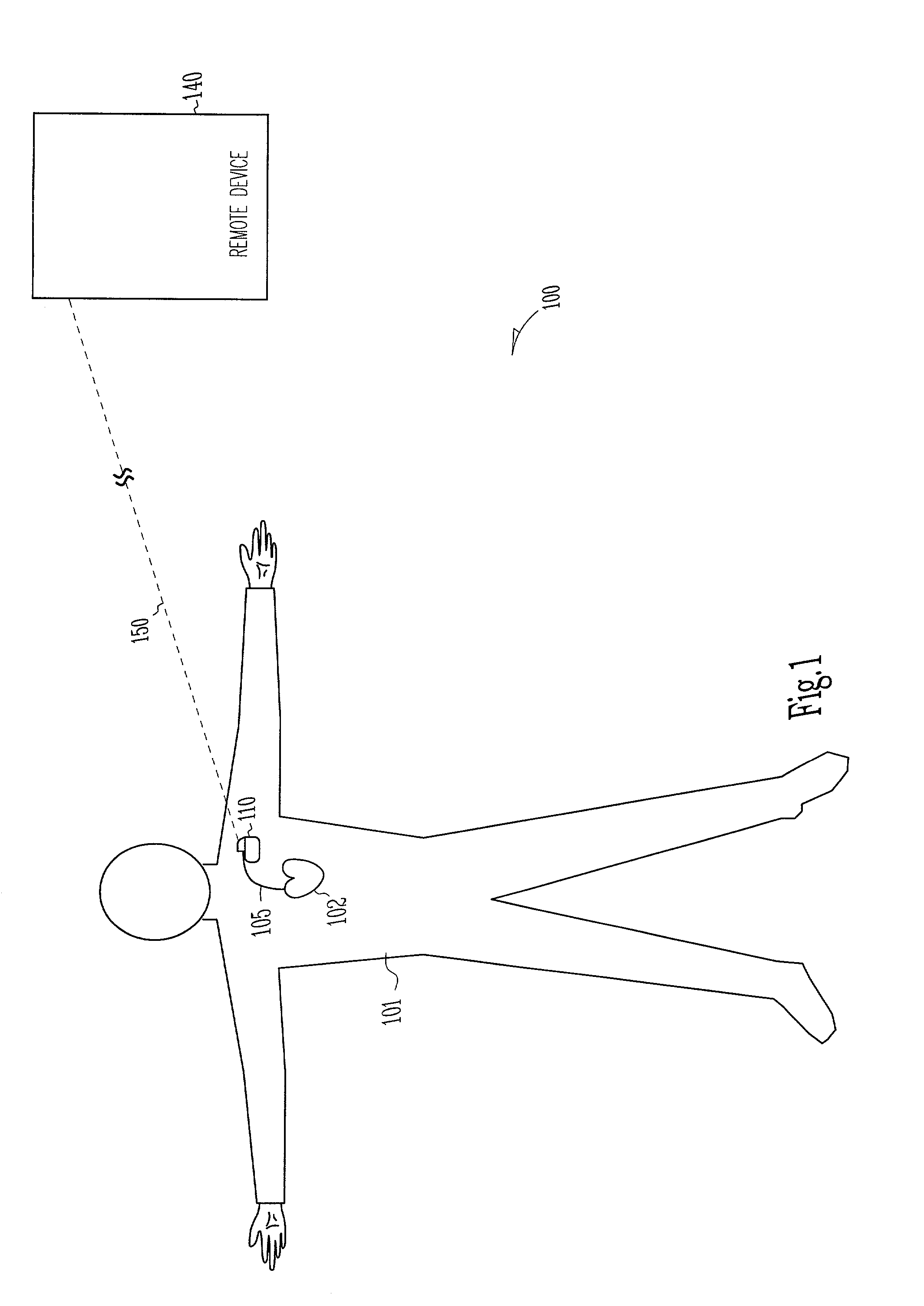 Methods and apparatuses for implantable medical device telemetry power management