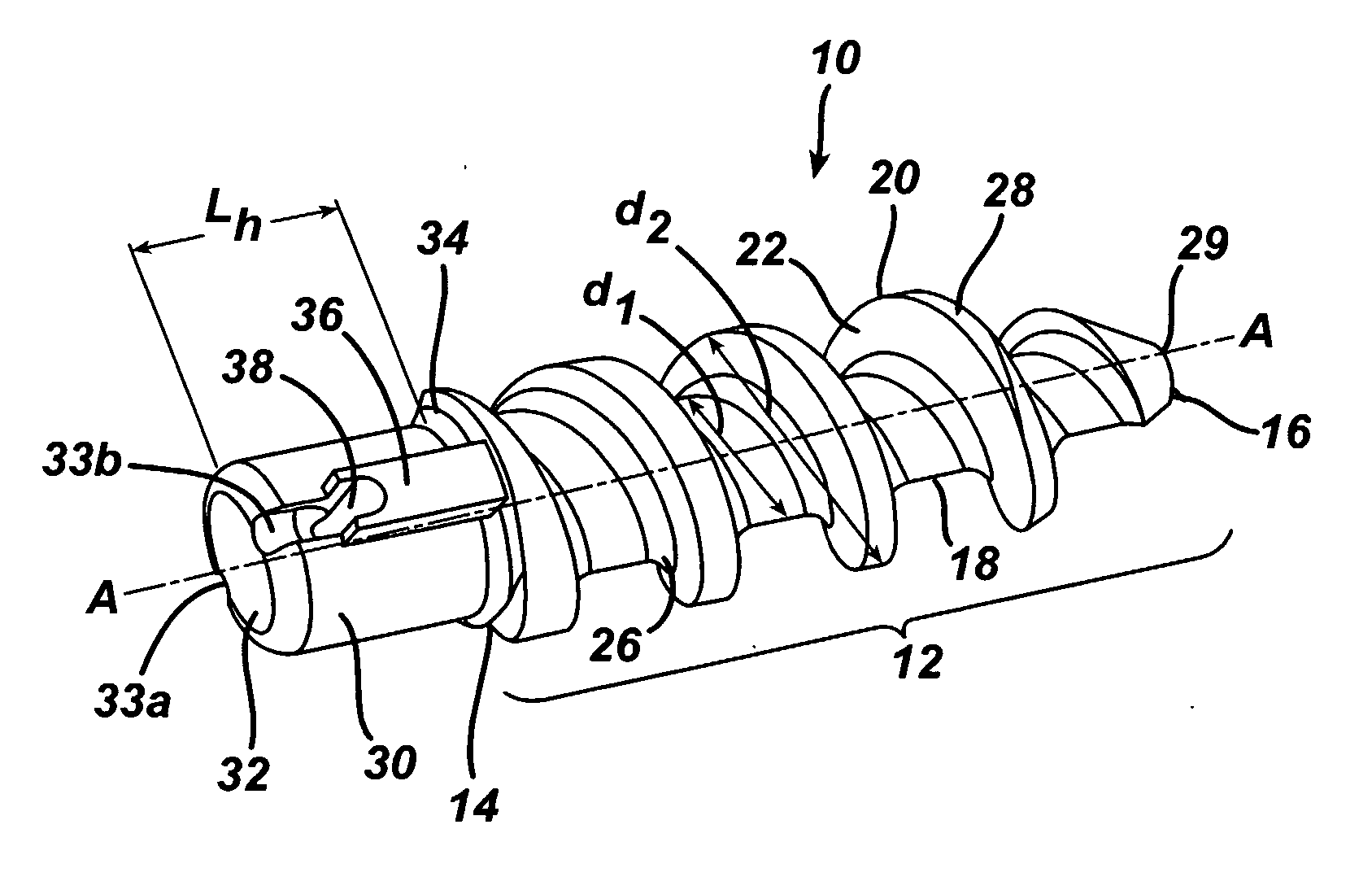Suture anchor with improved torsional drive head