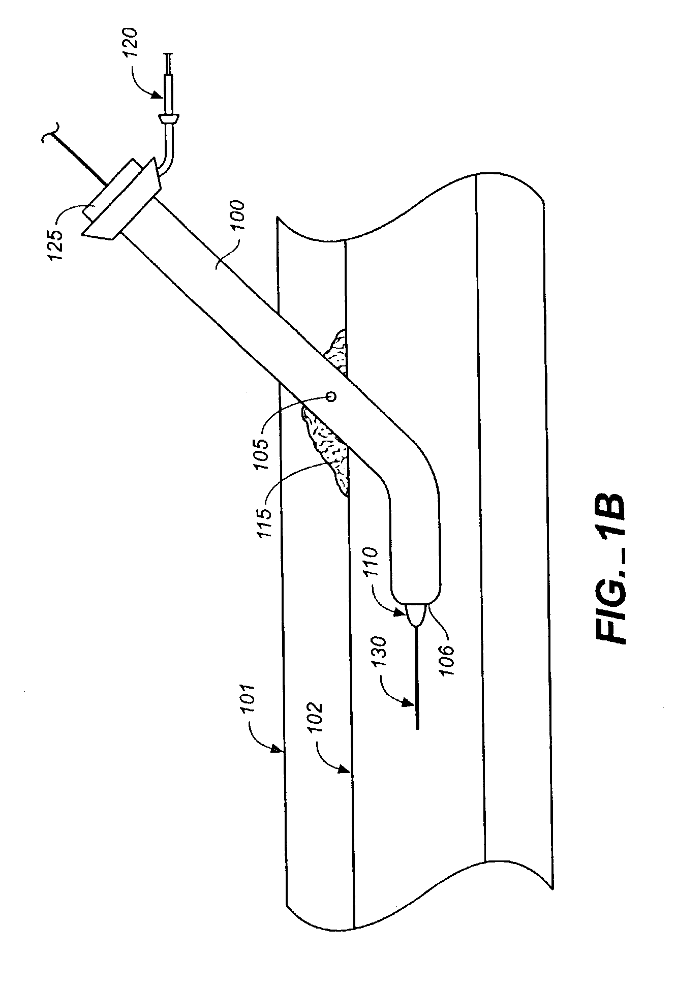 Vascular sealant delivery device and sheath introducer and method