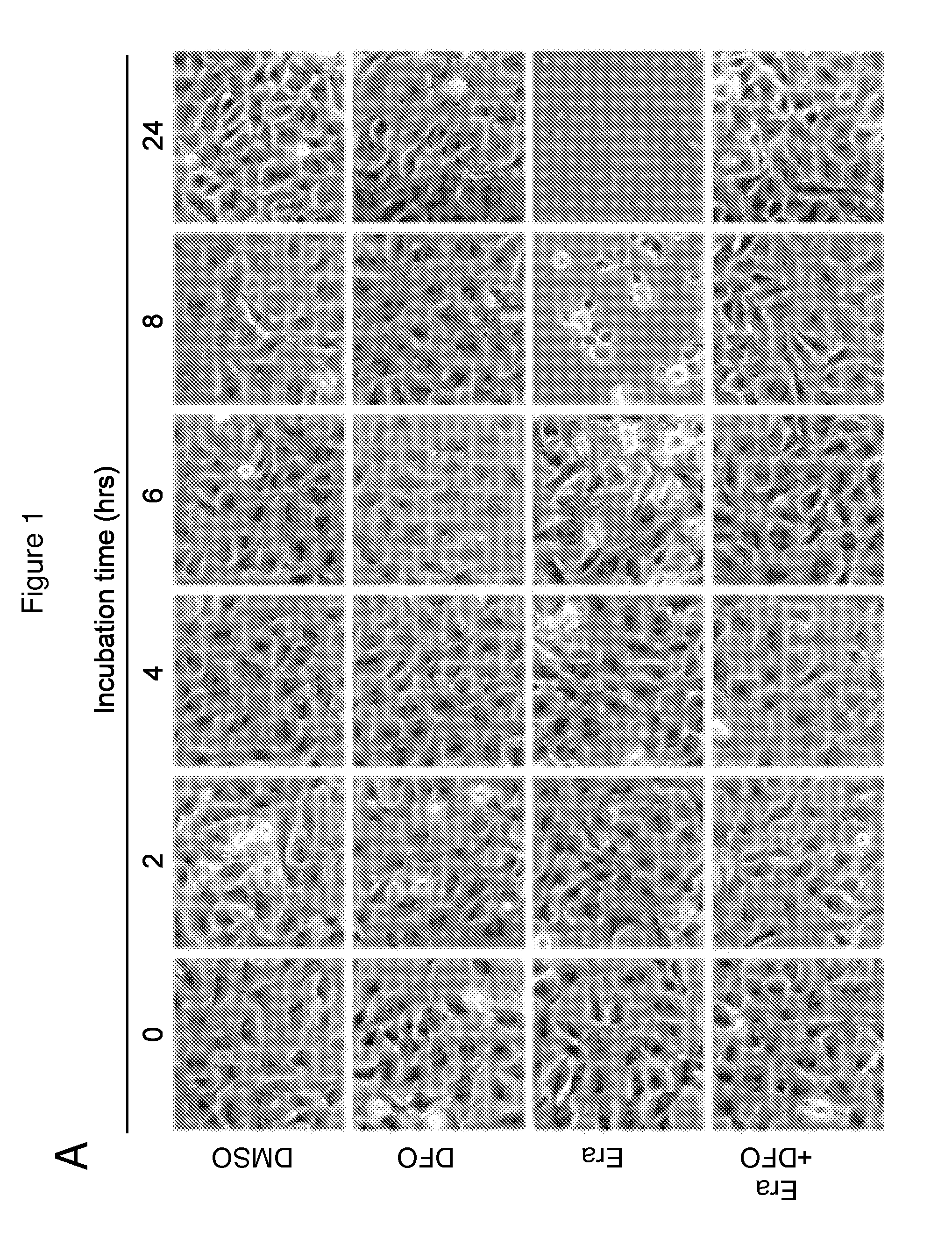 Compounds, compositions, and methods for modulating ferroptosis and treating excitotoxic disorders