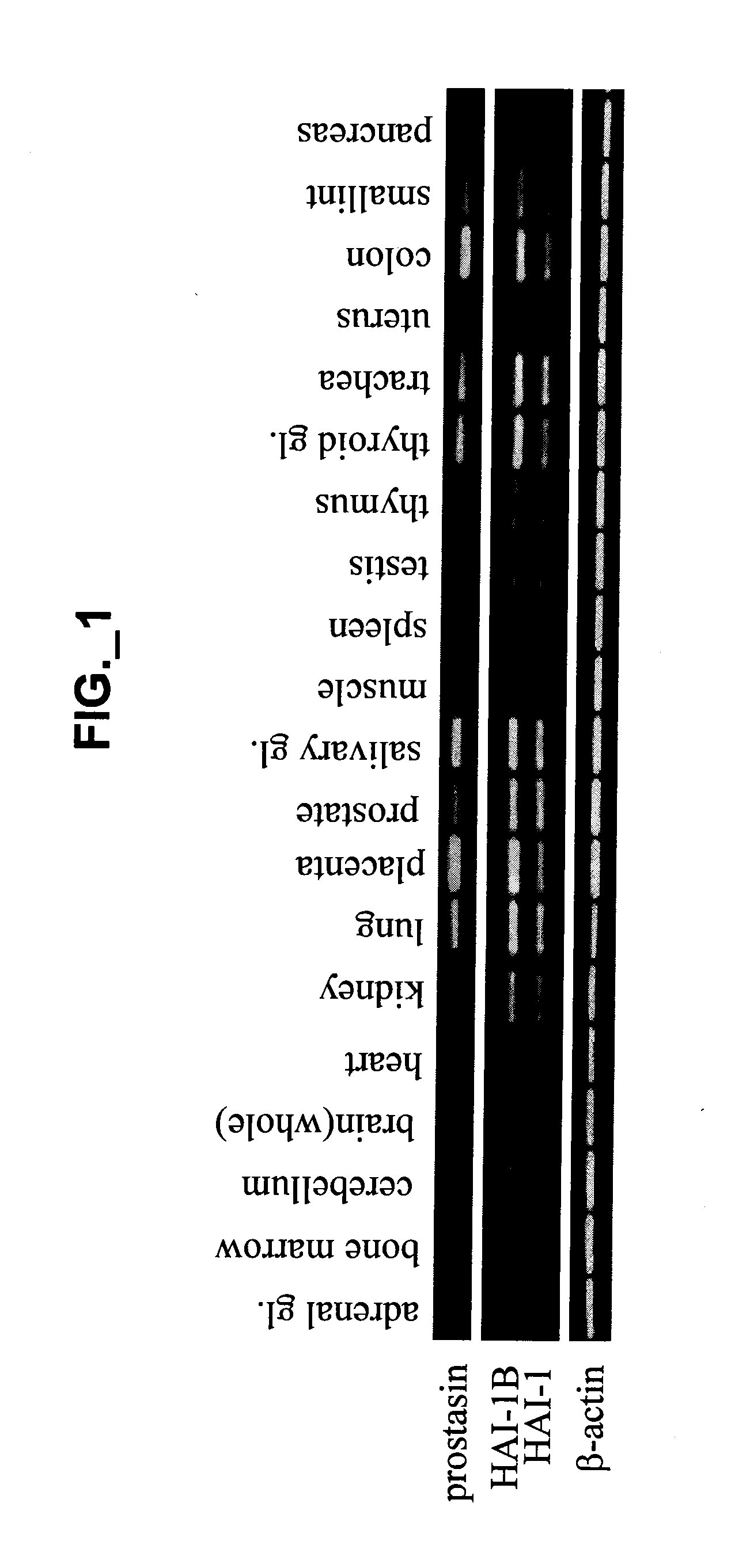 Methods and compositions for modulating prostasin