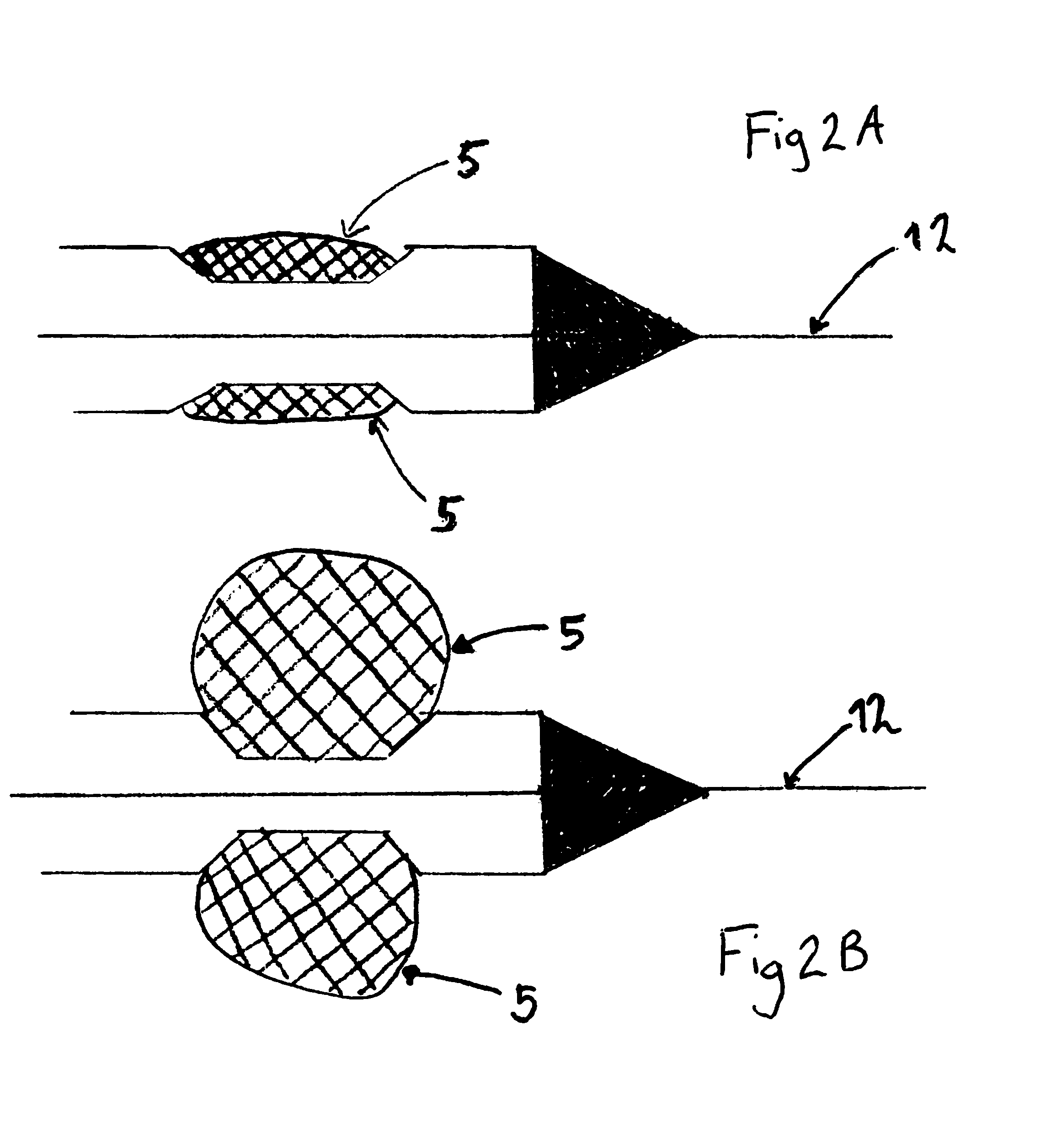 Method For Delivery Of An Embolic Protection Unit