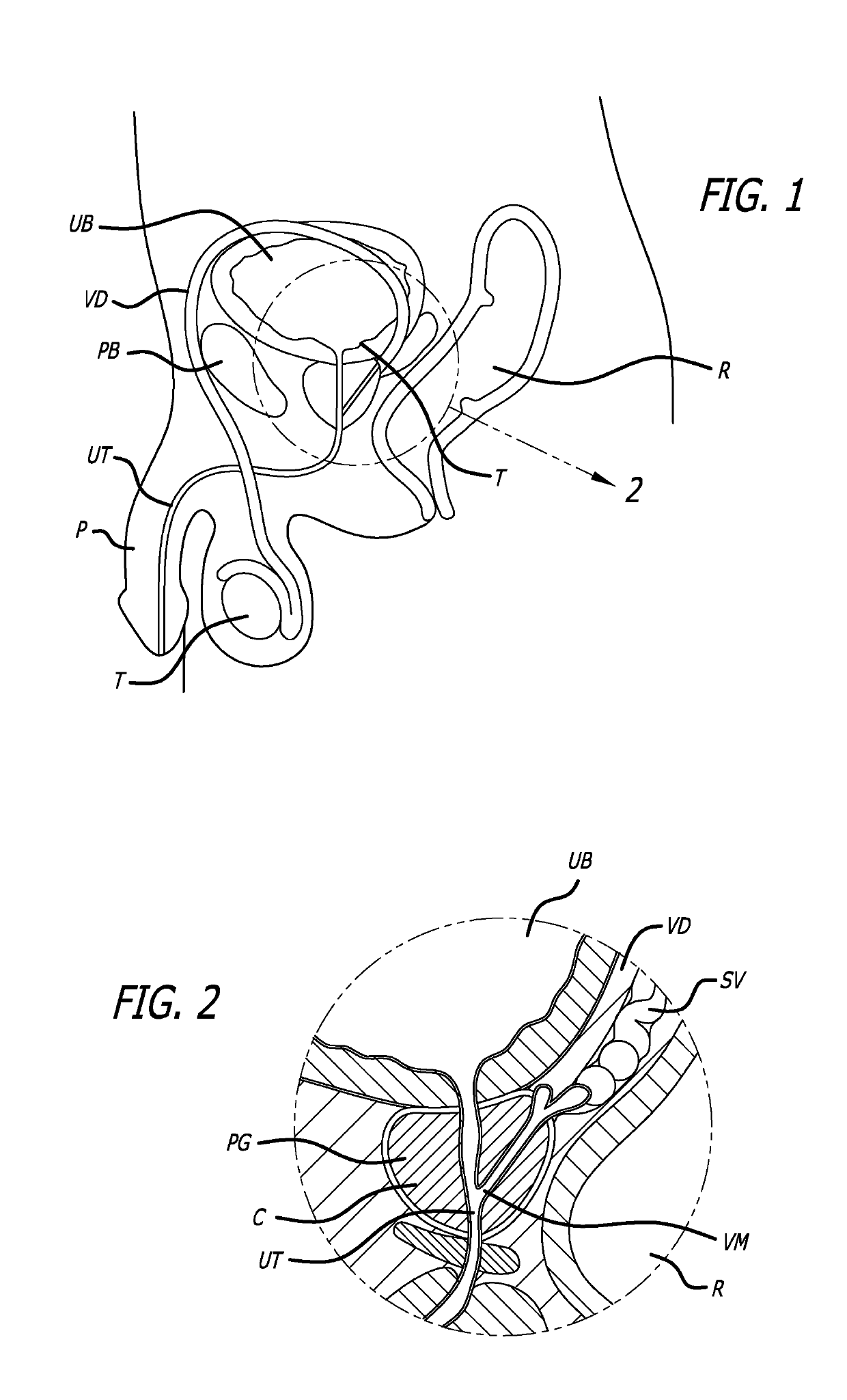 System for delivering anchors for treating incontinence