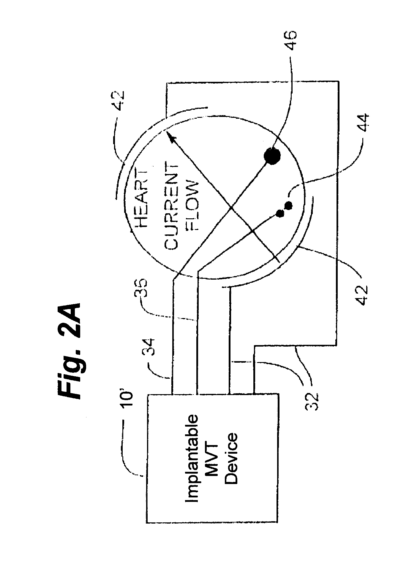 Adaptive medium voltage therapy for cardiac arrhythmias