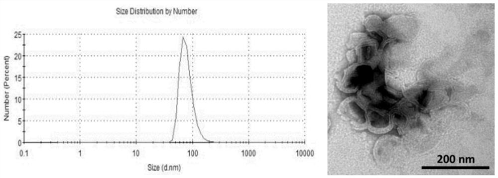 Extracellular Vesicle Isolation and Enrichment Method Based on Size Exclusion Chromatography and Ultrafiltration