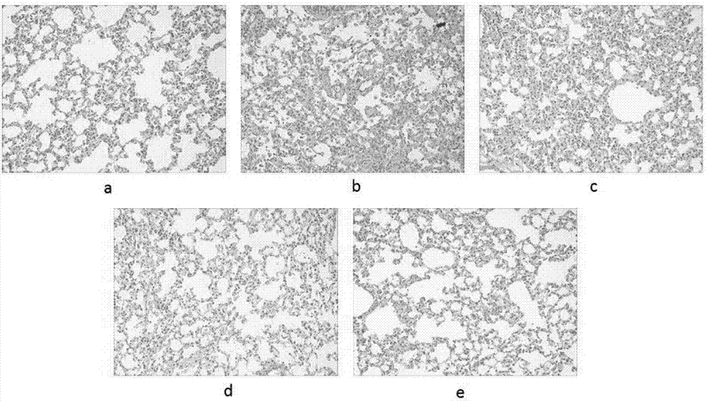 Application of honeysuckle flower extract extracted with petroleum ether to preparation of pulmonary fibrosis treatment drug