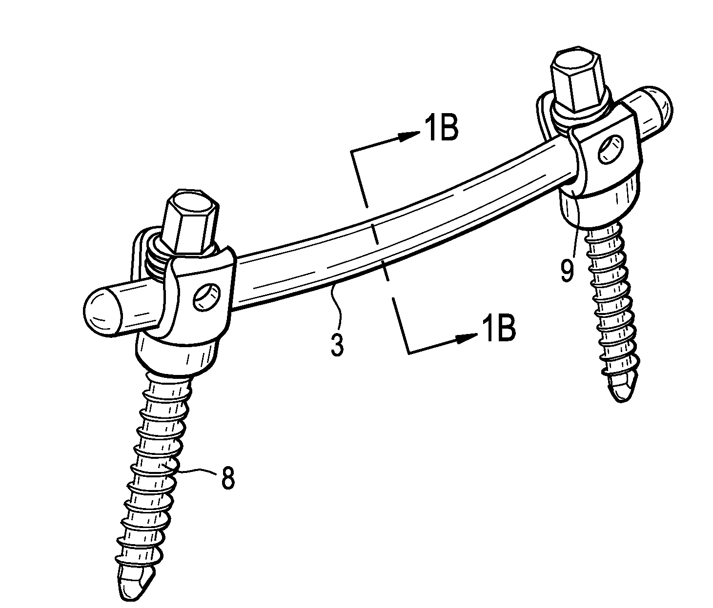 Polymeric Pedicle Rods and Methods of Manufacturing