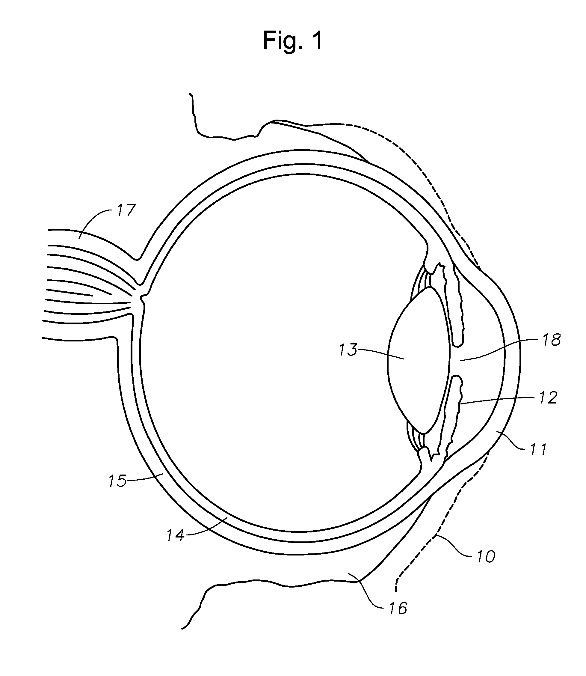 Devices And Methods For Ophthalmic Drug Delivery