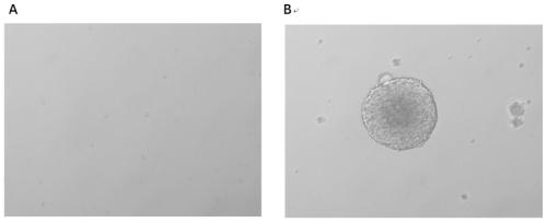 Application of blue light in affecting the proliferation and differentiation of neural stem cells