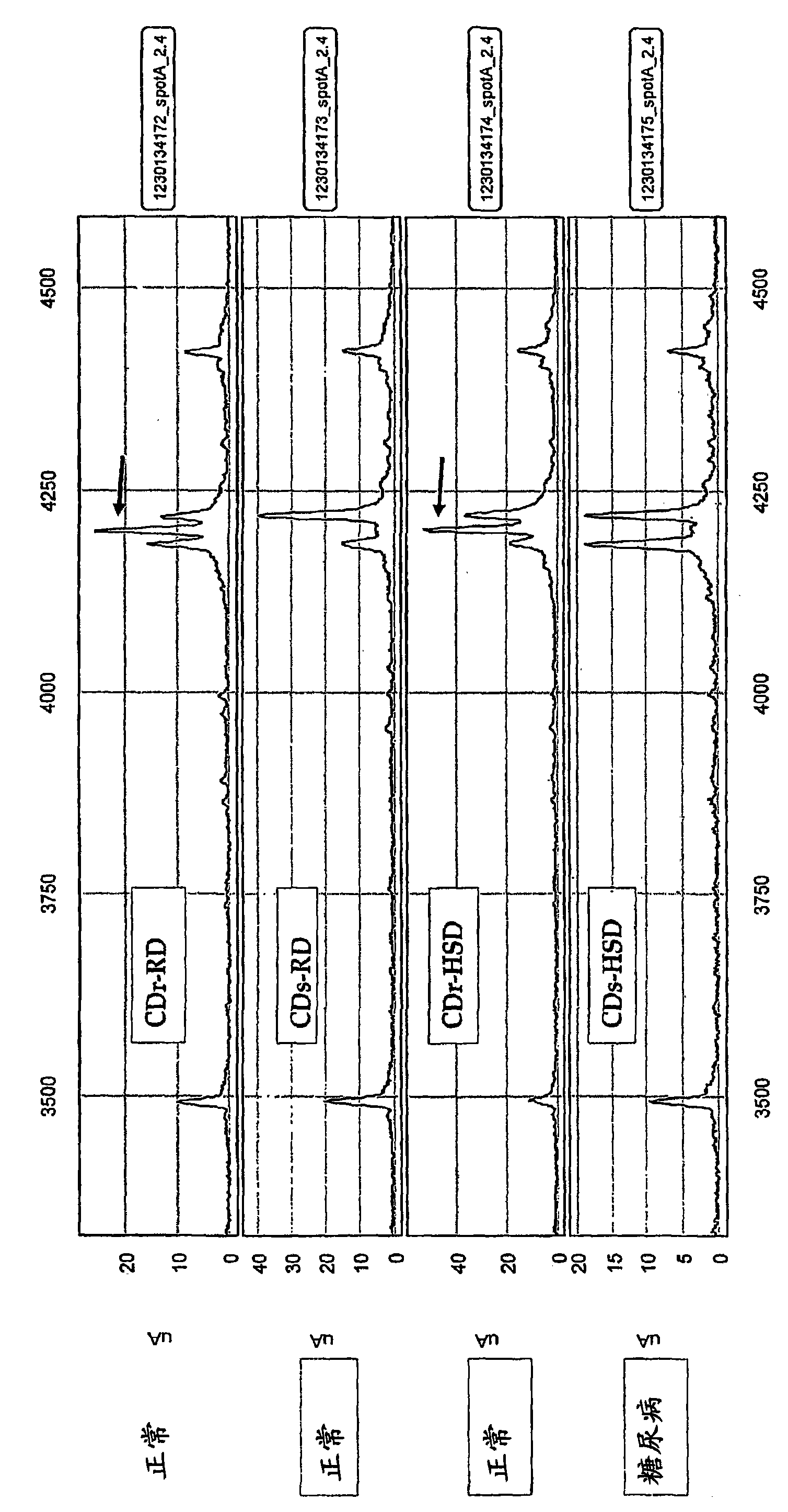 Compositions and methods for diagnosis and treatment of type 2 diabetes