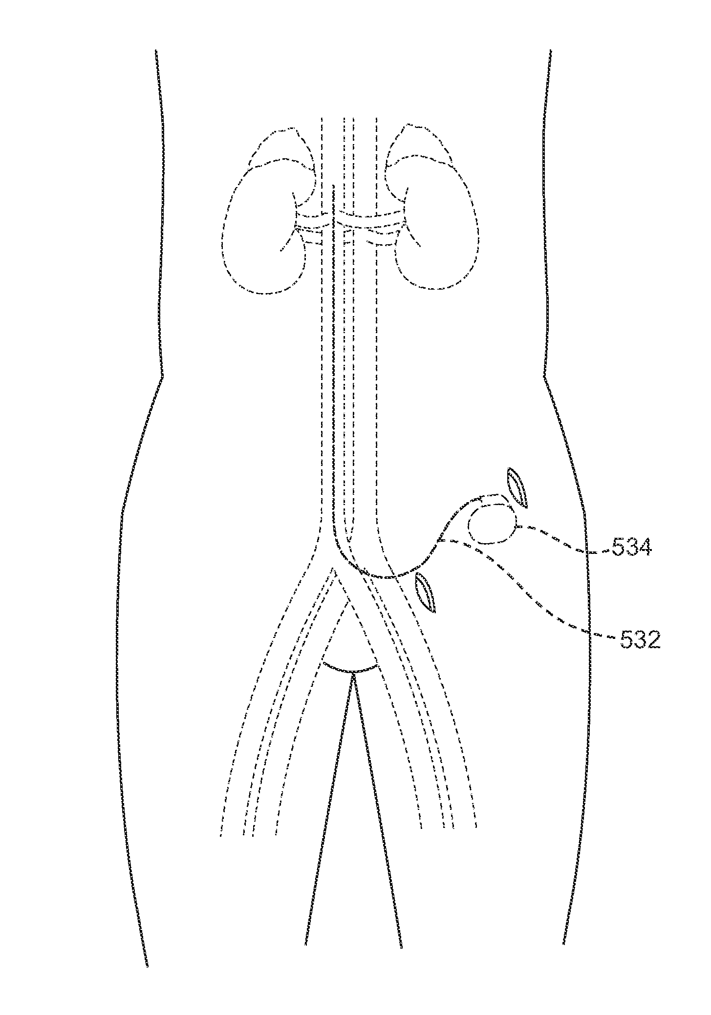 Methods and Devices for Adrenal Stimulation