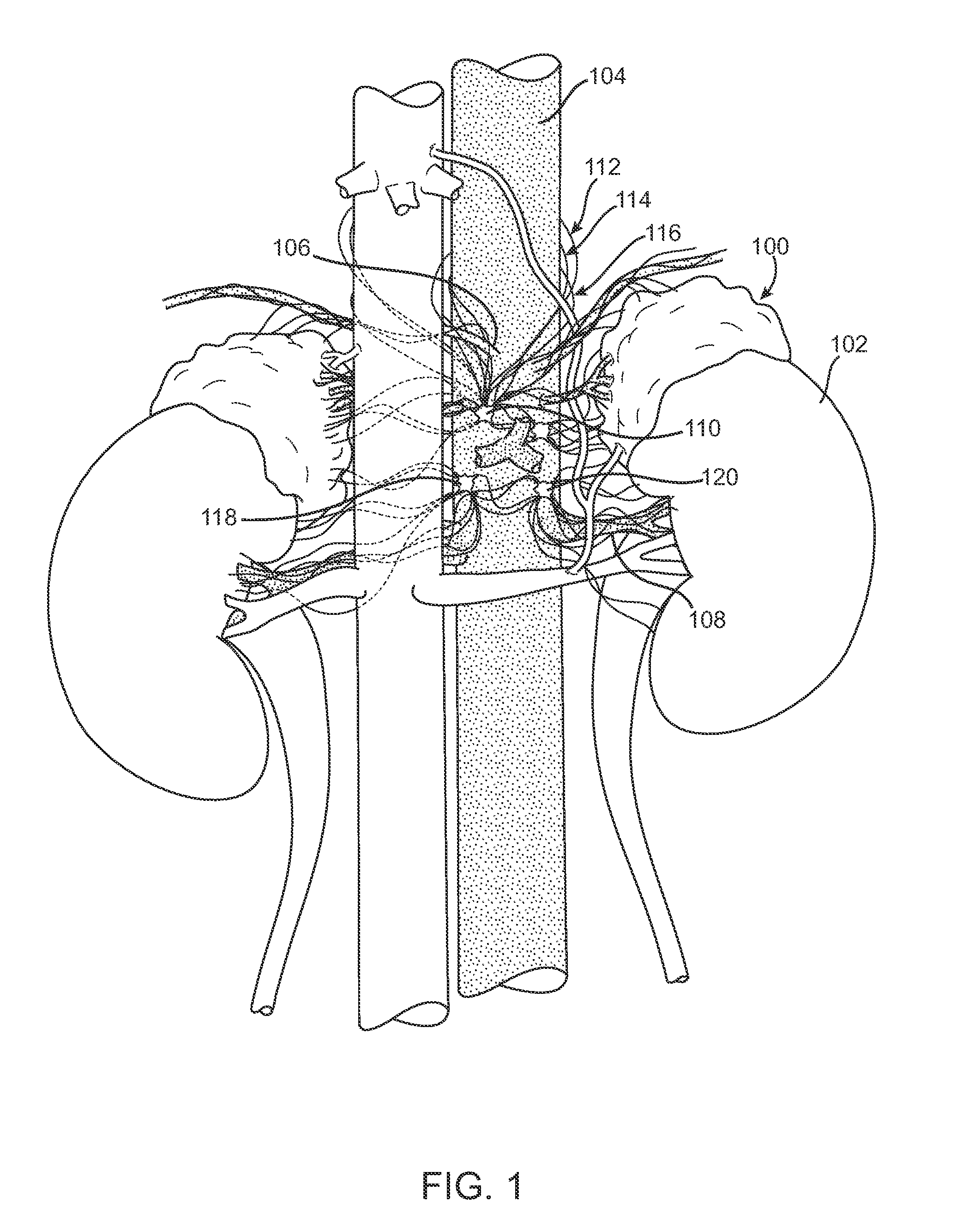 Methods and Devices for Adrenal Stimulation